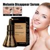 Whitening Essence Lighten Freckles Effective Brightening Remove Care Pigment Beauty Skin Facial W0C5