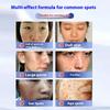 20mlWhitening & Spot-Removing Cream – Niacinamide Brightening Formula, Reduces Dark Spots, Improves Dullness, and Evens Skin Tone
