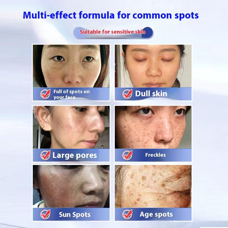 20mlWhitening & Spot-Removing Cream – Niacinamide Brightening Formula, Reduces Dark Spots, Improves Dullness, and Evens Skin Tone