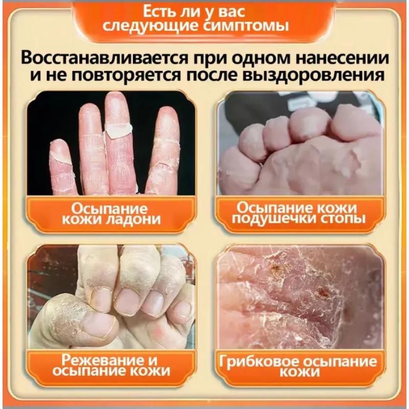 Medical Ointment for the Treatment of Cracks on Hands and Feet, 50g