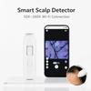 Cyfrowy Analizator Skóry Głowy 50X-200X Mikroskop do Włosów Trychoskop Narzędzie do Badania Skóry Głowy Kamera USB WiFi Android iOS Zdjęcia Wideo