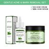 Conjunto de cuidados com a pele de acne de árvore do chá, soro facial, creme removedor de espinhas, tratamento para acne, controle de oleosidade, kits de cuidados com a pele facial, produtos