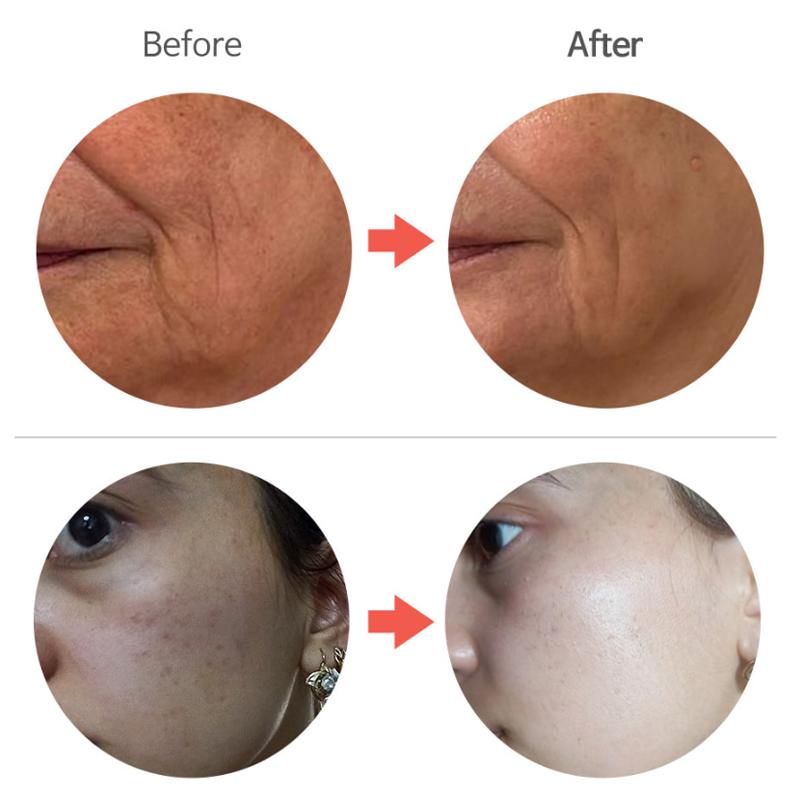 DERMALINE Bio Activing PDRN krém 100g