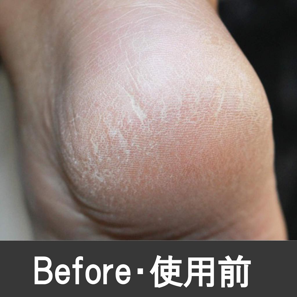 PERFECT NAILS Powerful Foot Heel Bathtime Tool Men's File, Waterproof, Exfoliating, Care, (Red)