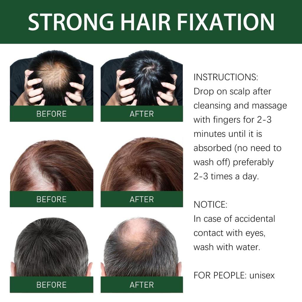 West&Month Ginger Hair Essence 30ml Thickening Hair Growth Serum Strengthens hair, repairs damage, reduces dandruff, improves frizz and dryness