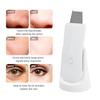 Ultrasonic Skin Scrubber Vibration Face Spatula Blackhead Remover Shovel Clean Cavitation Peeling Facial Lifting Skin Care LESEN