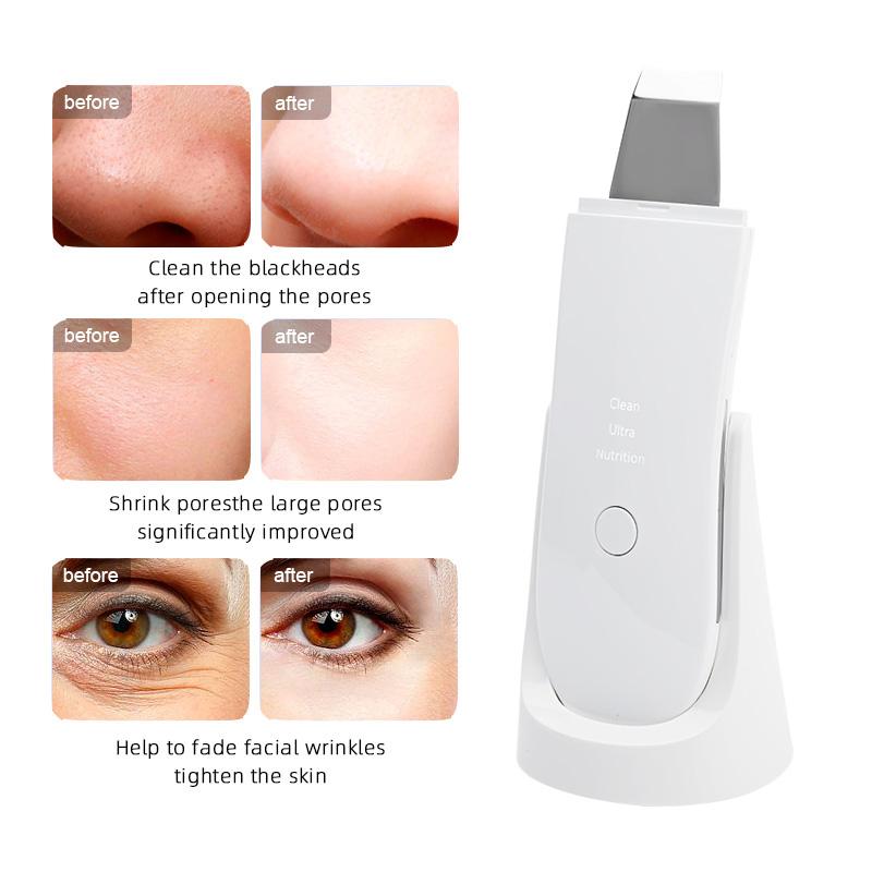 Ultrasonic Skin Scrubber Vibration Face Spatula Blackhead Remover Shovel Clean Cavitation Peeling Facial Lifting Skin Care LESEN