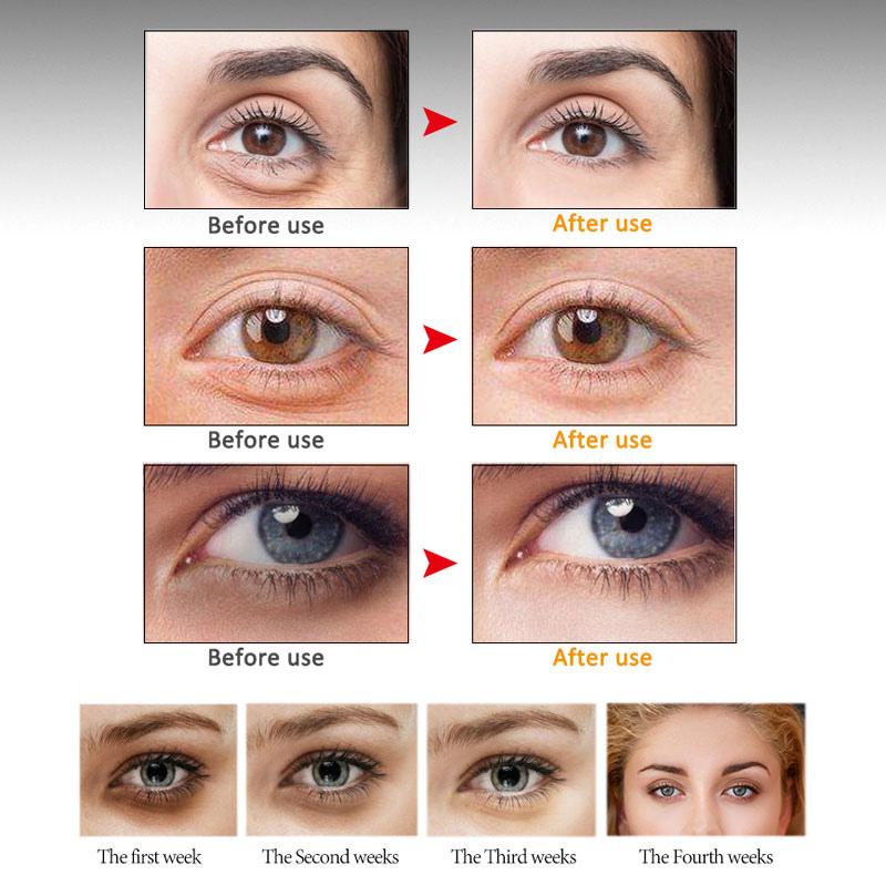 Anti Wrinkle Peptide Eye Cream with Titanium Balls Dark Circles Remover Anti Swelling Massager for Skin Care Treatment