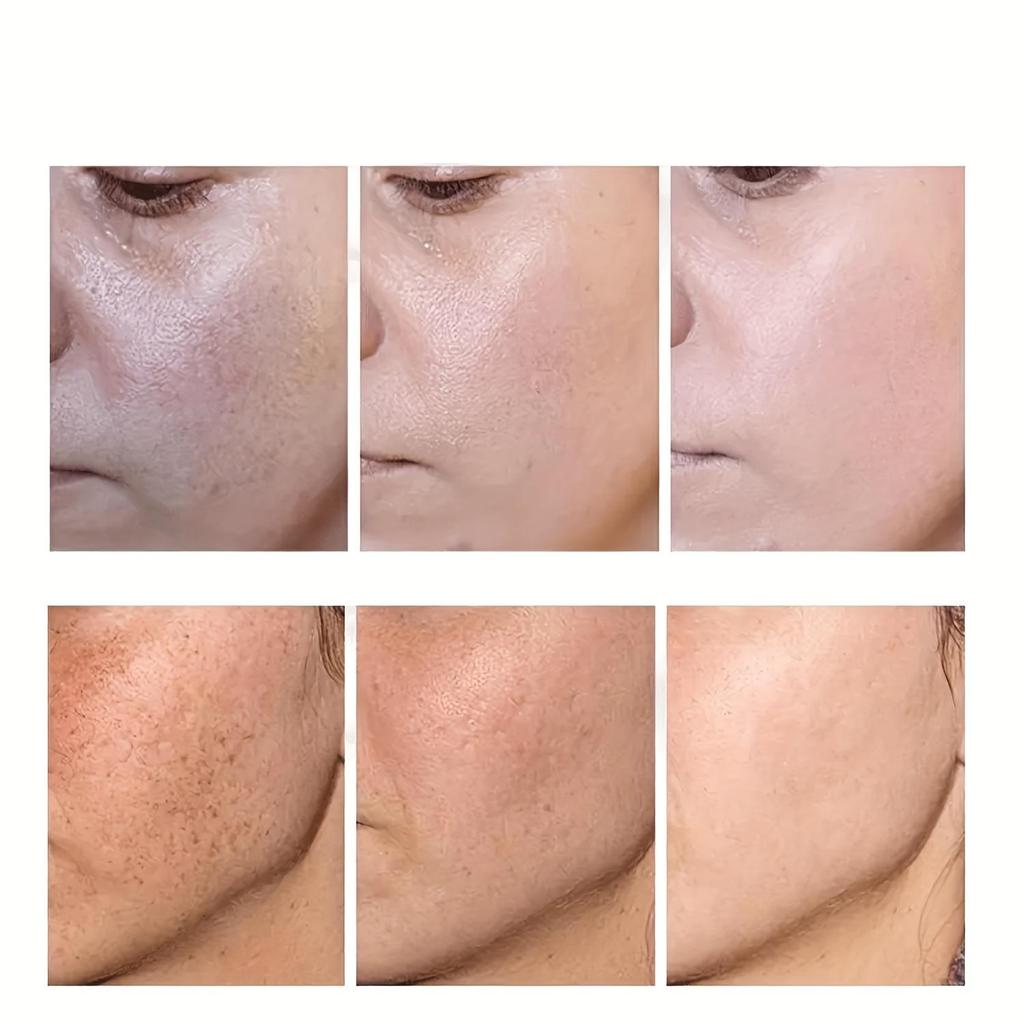 Moisturizing and Moisturizing Cream with Cream Texture Improves Skin Condition, Uniforms Skin Color, Nourishes Skin Care Cream