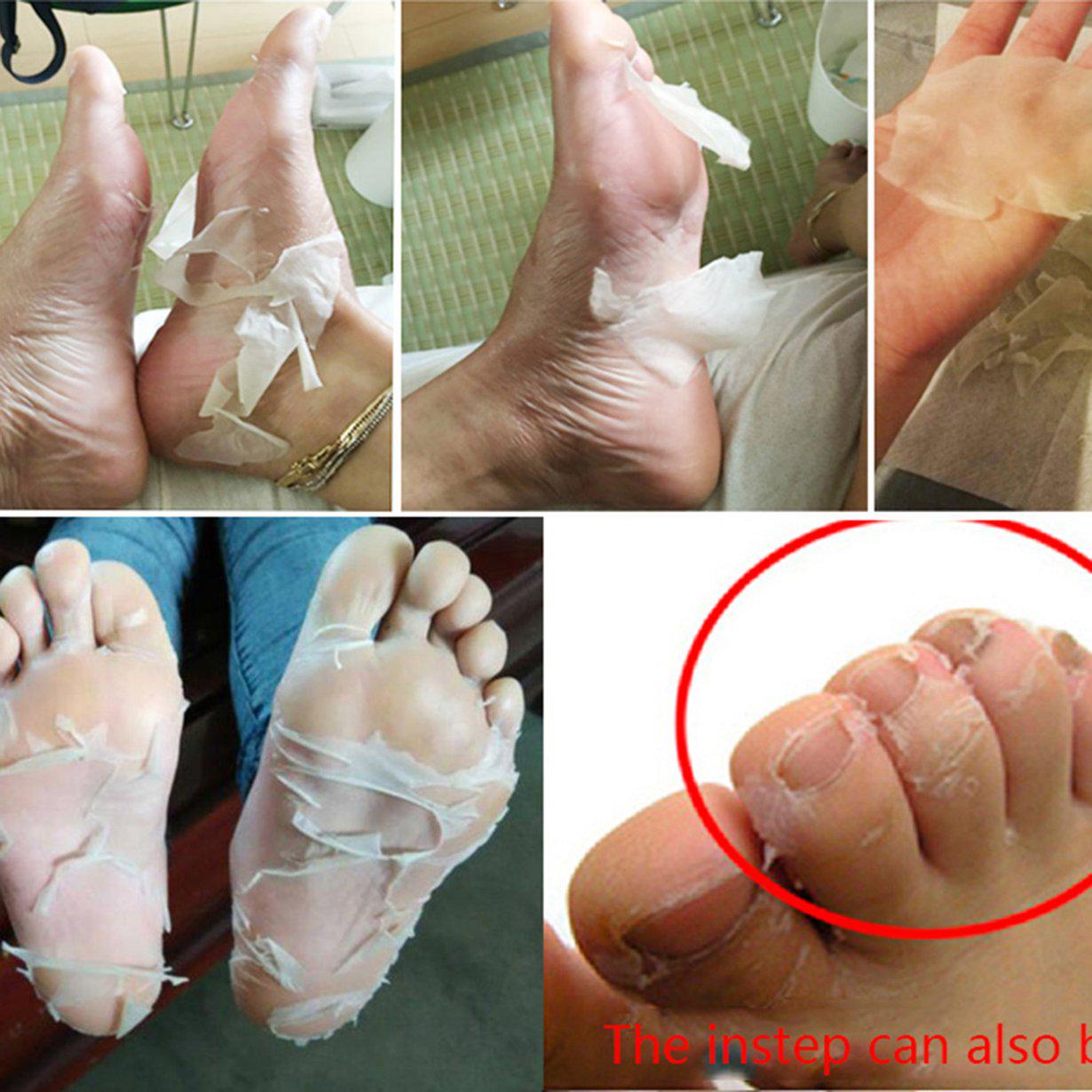 

Носочки для удаления огрубевшей кожи. Хорошо подойдут, для домашнего использования