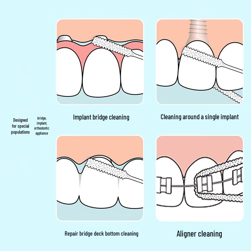 Tepe Expanding Dental Floss