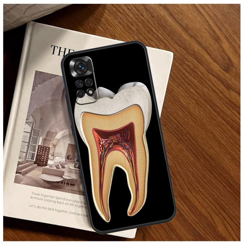 Human Tooth Anatomy Case For Xiaomi Redmi Note 13 9 10 11 12 14 15 Pro Plus Cover For Redmi 15 C 12C 13C 14C 10C