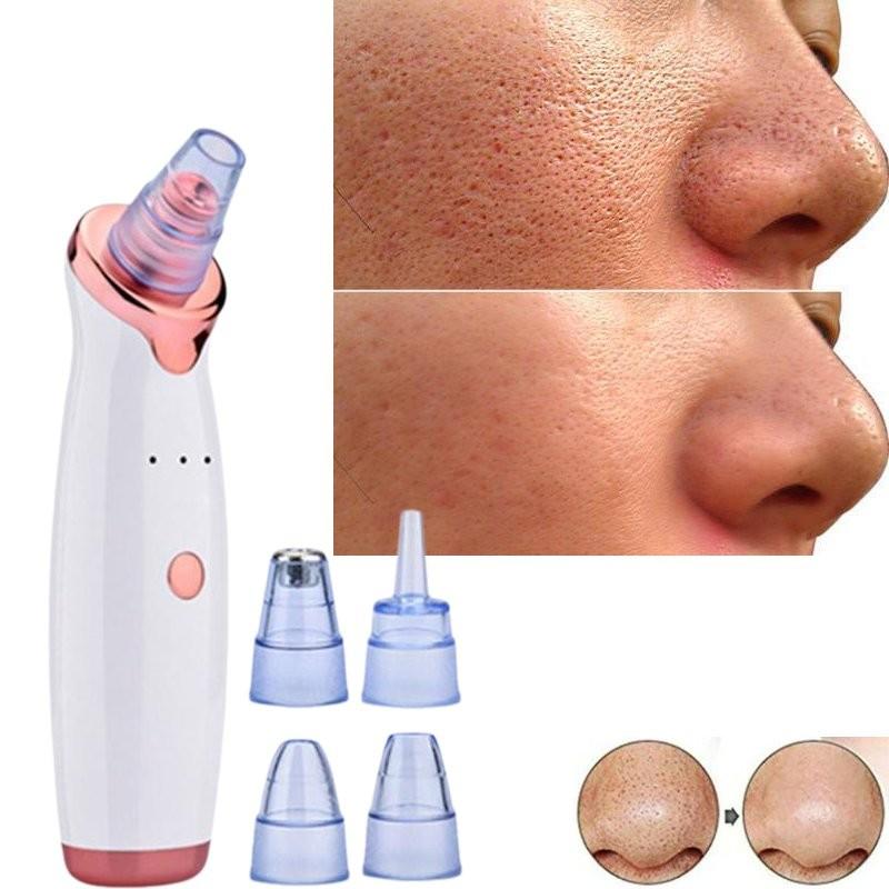 2020 Model Electric Blackhead Vacuum Cleaner For Deep Pore Cleansing And Care