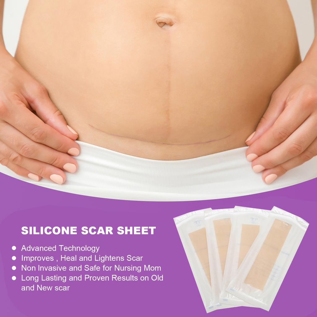 4pcs Silicone Scar Sheets Home Travel Reusable Adhesive Scar Removal Treatment Strips