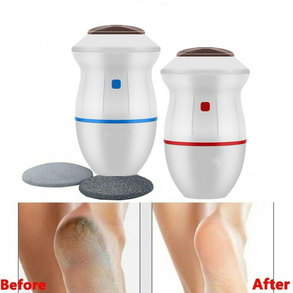 Electric Portable Foot Grinder File Vacuum Hard Skin Callus Remover Machine