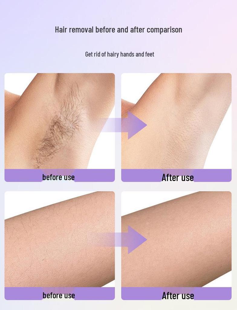 Rechargeable Women's Epilator & Facial Shaver