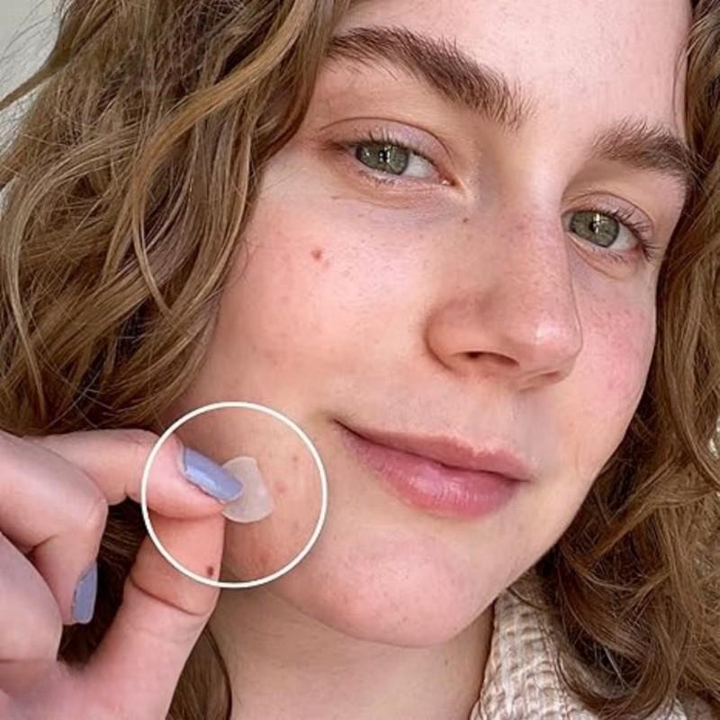 720 Pcs Circular Transparent And Skin Tone Acne Patches Skincare Stickers Facial Spot Covering Makeup Tools