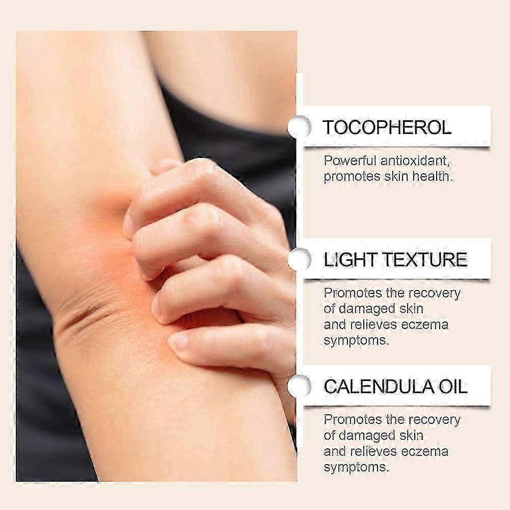 Eczemas Relief Cream Skin Redness Relief Anti-itch Lotions For All Skin Types