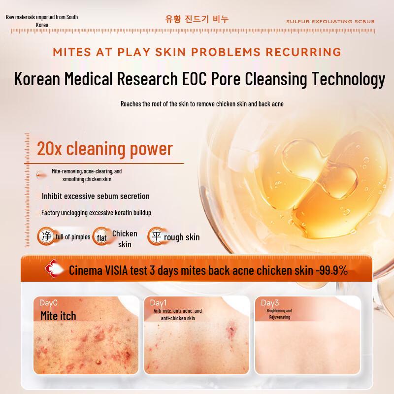 SEEDONVEUR Sulfur Mite Removal Scrub Shower Gel