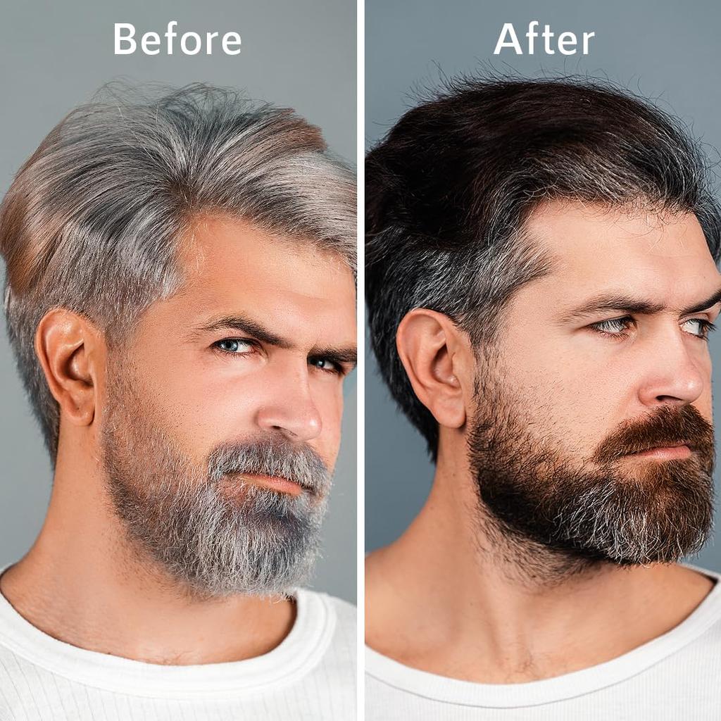 nti-Gray Hair Serum With Arcolys, Melanogray, Black Seed Oil & Hibiscus Extract | Light-Weight, Non-Sticky Formula, Paraben Free & Cruelty Free, 50 ML