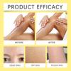 Ouhoe Bee Venom Skin Care Soap Moisturizing Nourishing Cleansing Body Bar For Radiant Skin