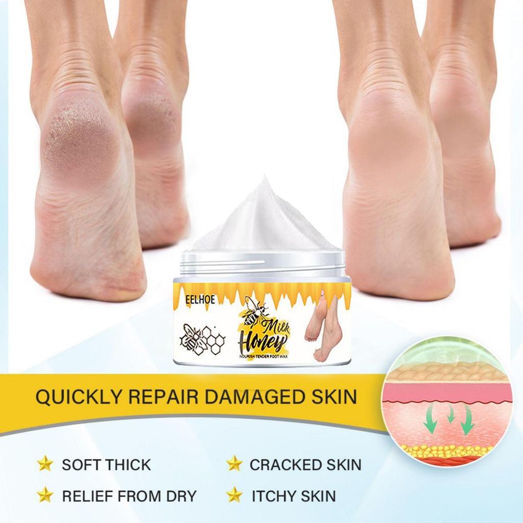 Sprukne hender og føtter reparerer krem, fukter, gir næring til huden og etterlater huden myk og delikat