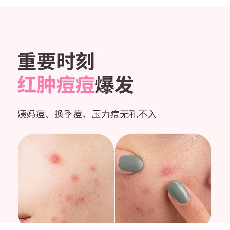 YAOZHI - Pure Radiance Acne Pimple Patch - 3 Types