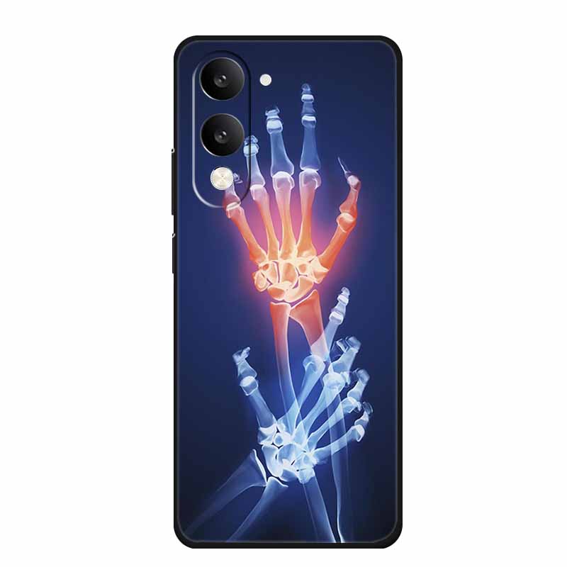 For Vivo Y29T Y29s Case Y 29 T S Coque Flowers Black Silicone Soft Back Cover For Vivo Y19s GT 5G iQOO Z10 Lite Phone Case Funda
