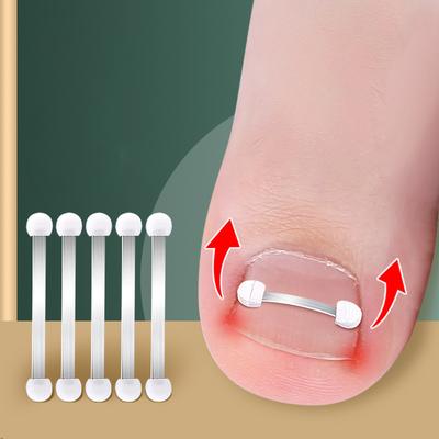 Herramientas Correctoras de Uñas Encarnadas Pedicura Recuperar Uña Encarnada Tratamiento Profesional Corrección de Uñas Encarnadas Herramienta para el Cuidado de los Pies