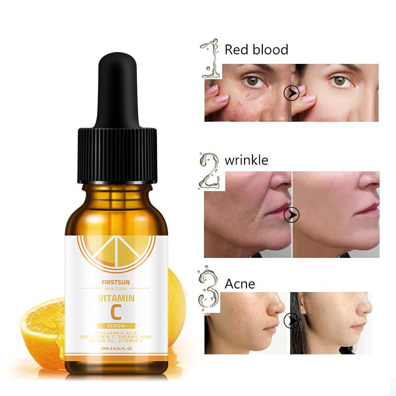 10 ml Hyaluronsäure, Vitamin C, aufhellende Gesichtspflege von Nourishing Essence Beauty
