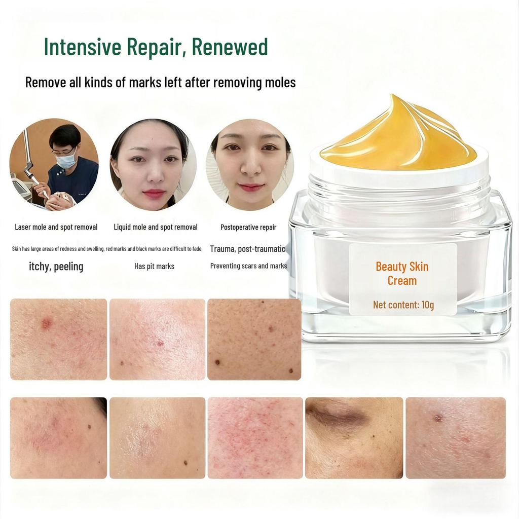 Repair Cream for Sunburns, Freckles, and Moles - Nourishes, Reduces Redness & Swelling, and Soothes Skin - Salon Exclusive