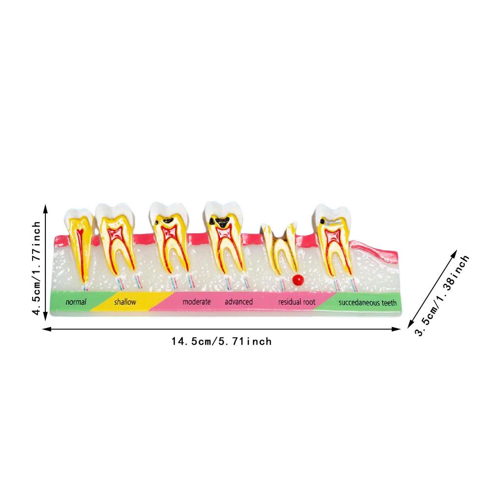 Demonstration Tooth Model Soft Education Clean Display Removable Dental Model Dental Teaching Teaching Tool Standard Tooth