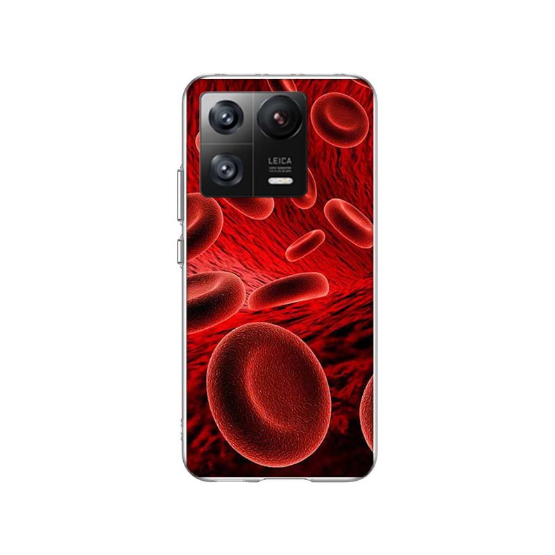Blood Platelets Under Microscope Phone Case For Xiaomi Poco F7 Ultra X7 X6 M8 M7 M6 M4 M3 Pro X4 Mi 15 15T 14 14T 12T 12S 10T Pr