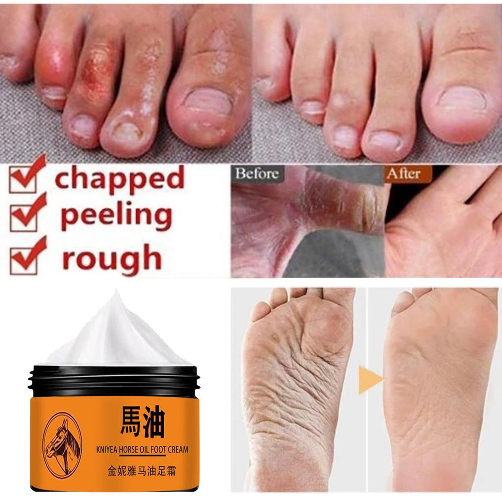 Foot Cream Heel Crack Repair Cream Dead Skin Removing Hand and Foot Care Moisturizing Cream