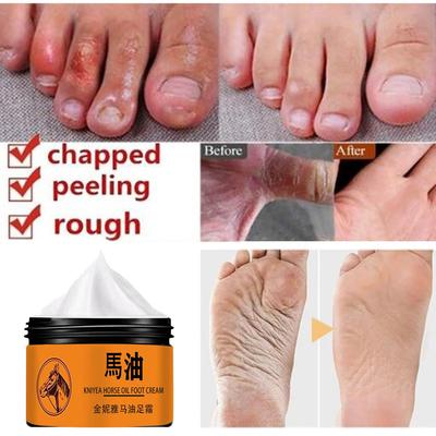Foot Cream Heel Crack Repair Cream Dead Skin αφαίρεσης χεριών και ποδιών Ενυδατική κρέμα περιποίησης