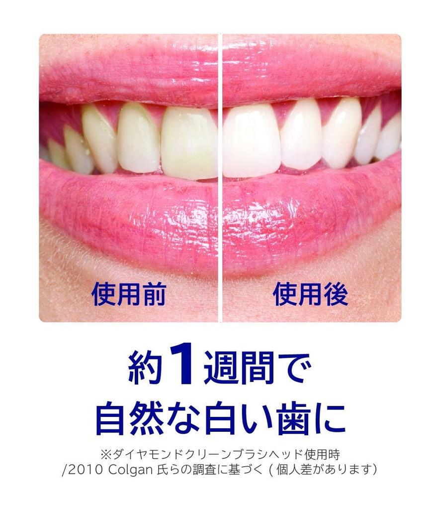 Philips Sonicare Diamond Clean Electric Toothbrush White [2014 Model] HX9302/11