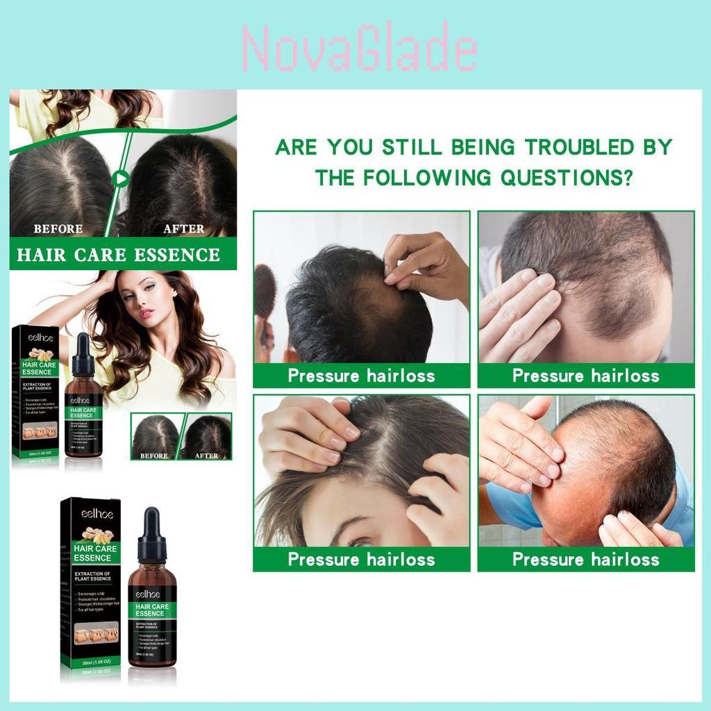 Eelhoe Ginger Hair Essence Strengthening Serum For Thicker And Healthier Hair