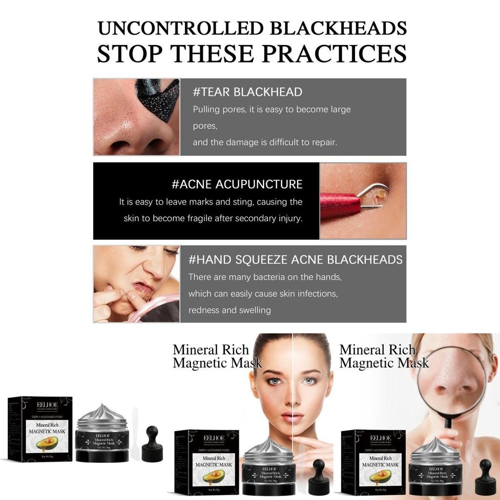Eelhoe Blackhead Removal Mask Deep Cleansing And Pore Tightening For Oily Skin