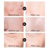 VENZEN Pflanzenextrakte Männer Serum Anti-Falten Straffende Schrumpfen Poren Creme Whitening Anti-Aging Feuchtigkeitsspendende Hautpflege