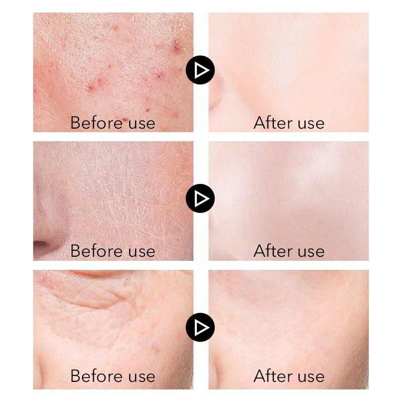 VENZEN Pflanzenextrakte Männer Serum Anti-Falten Straffende Schrumpfen Poren Creme Whitening Anti-Aging Feuchtigkeitsspendende Hautpflege