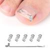 Stainless Steel Lever Hook Ingrowns Toenail Tool Elastic Bands Adjustable Corrector For Men And Women