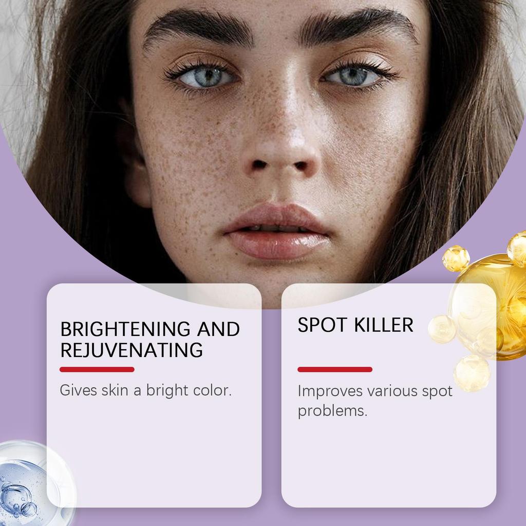 Whitening Freckle Cream Melasma Dark Spots Pigmentation Removal Product Fade Stain Melanin Fast Repair Brighten Korean Skin Care