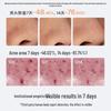 Hi!papa Teen Oil Control Acne Facial Cleanser