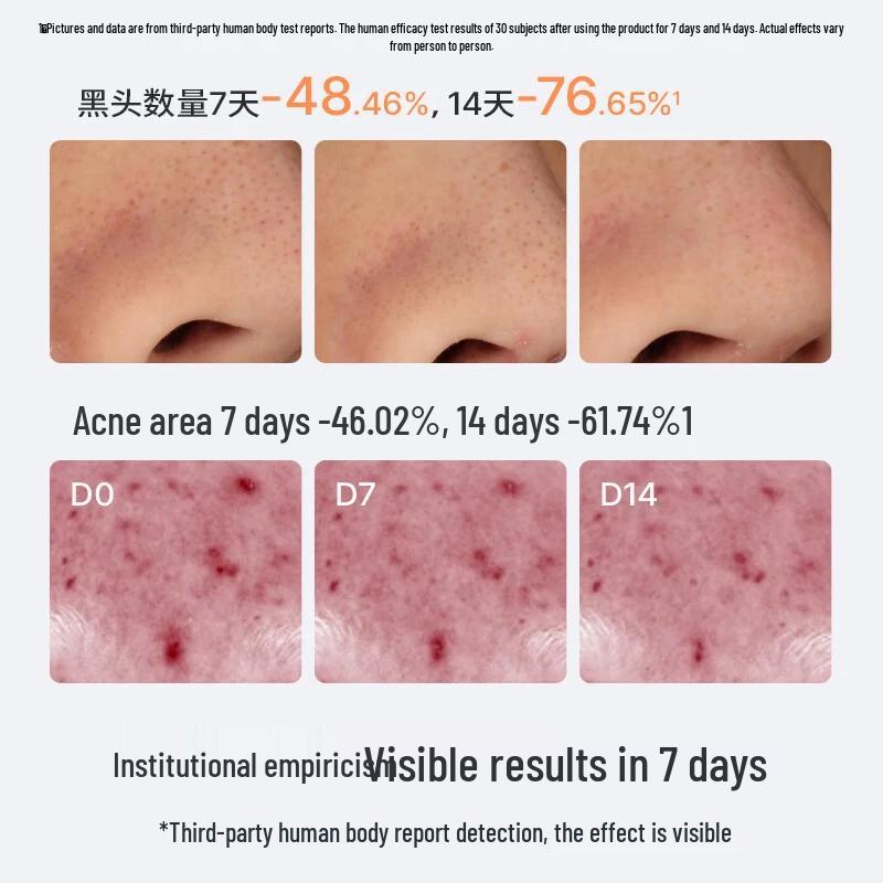 Hi!papa Teen Oil Control Acne Facial Cleanser