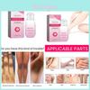 Radiant Eelhoe Women's Brightening Essence For Underarm And Joint Skin Care 30ml