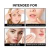 Hoygi Cute Black Acne Patch, Reduces Spots, Blackheads, Acne, Lightens Pimples, Balances Tone, Acne Patch