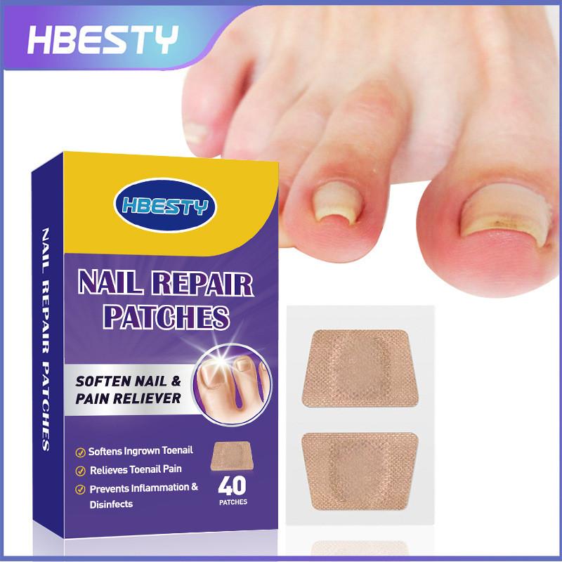 

Toenail Hbesty Universal Restoration Patches For Nail Grooves And Soft Healing Nail