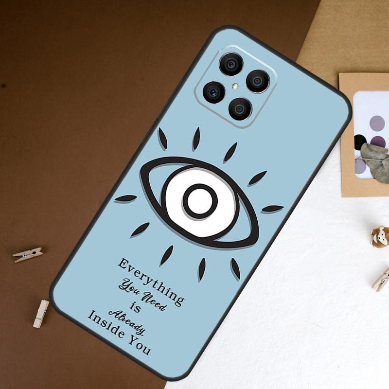Big Eyes Cartoon Pattern Case For Honor 70 50 90 Lite Magic 6 5 Pro Cover For Honor X8a X9a X7a X6a X9b X8 X9 X7 8X