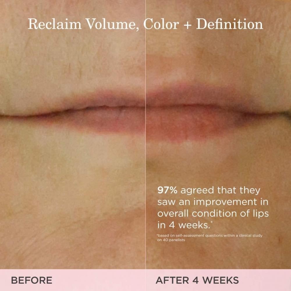 Tatcha The Kissu Lip Treatment 0.34 Oz   10ml 0.34 Oz   10ml