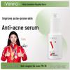 Weifuya Niacinamide Acne Treatment Serum 35ml